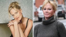 Sztárok, akiknek tönkretette a karrierjét a plasztika: Melanie Griffith és Jennifer Gray is bánja a műtéteket