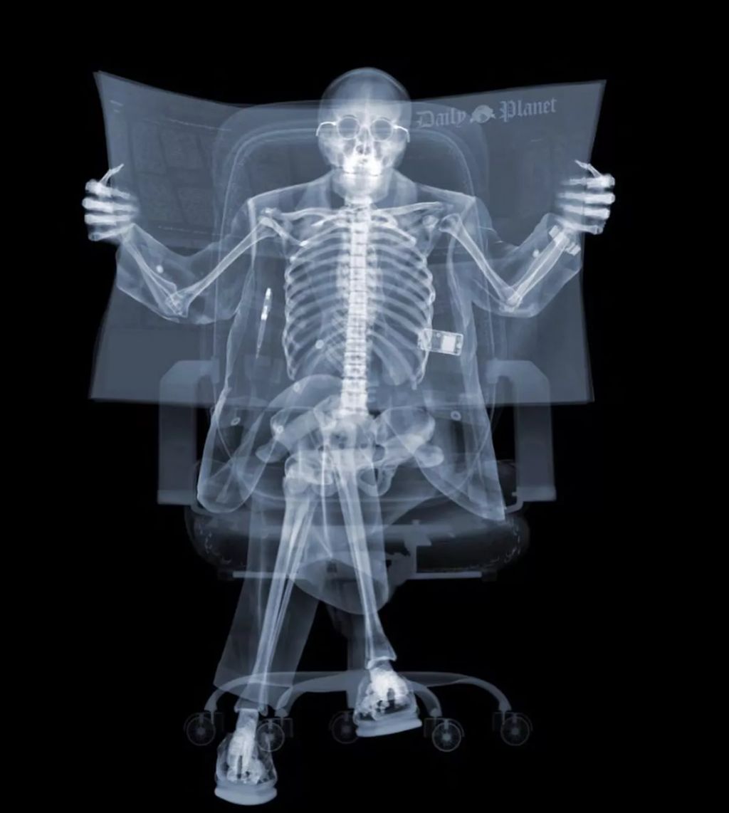 Forrás: Instagram/nickveaseyxray
