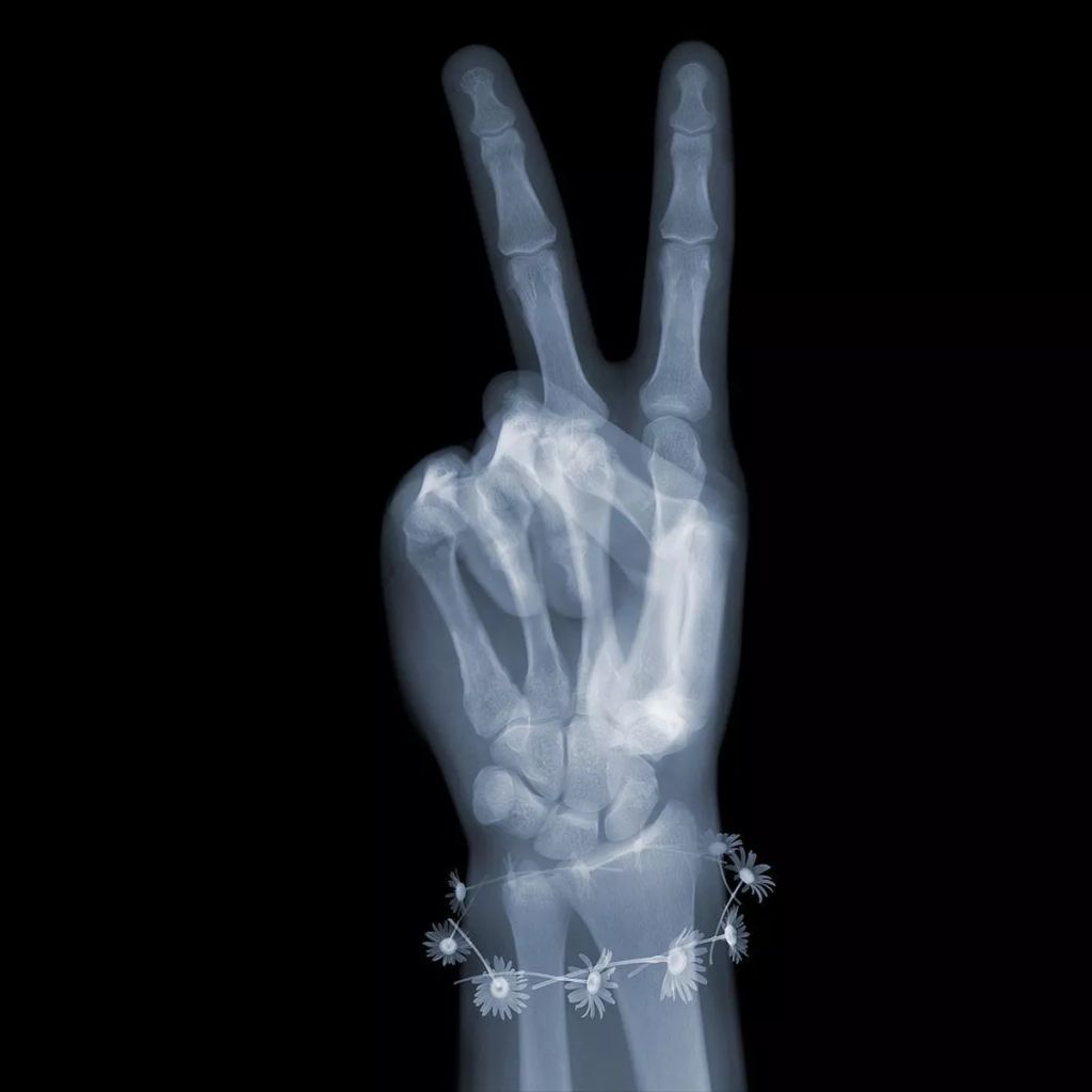 Forrás: Instagram/nickveaseyxray