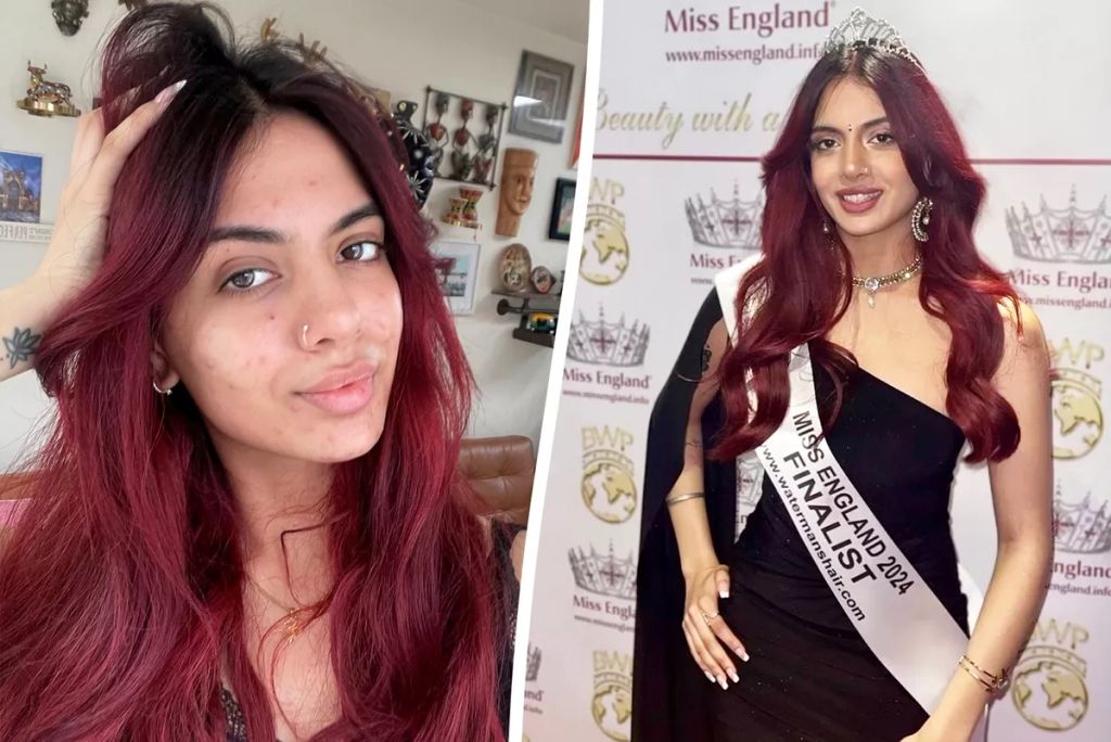 Beauty queens show off imperfections as part of Instagram v Reality campaign