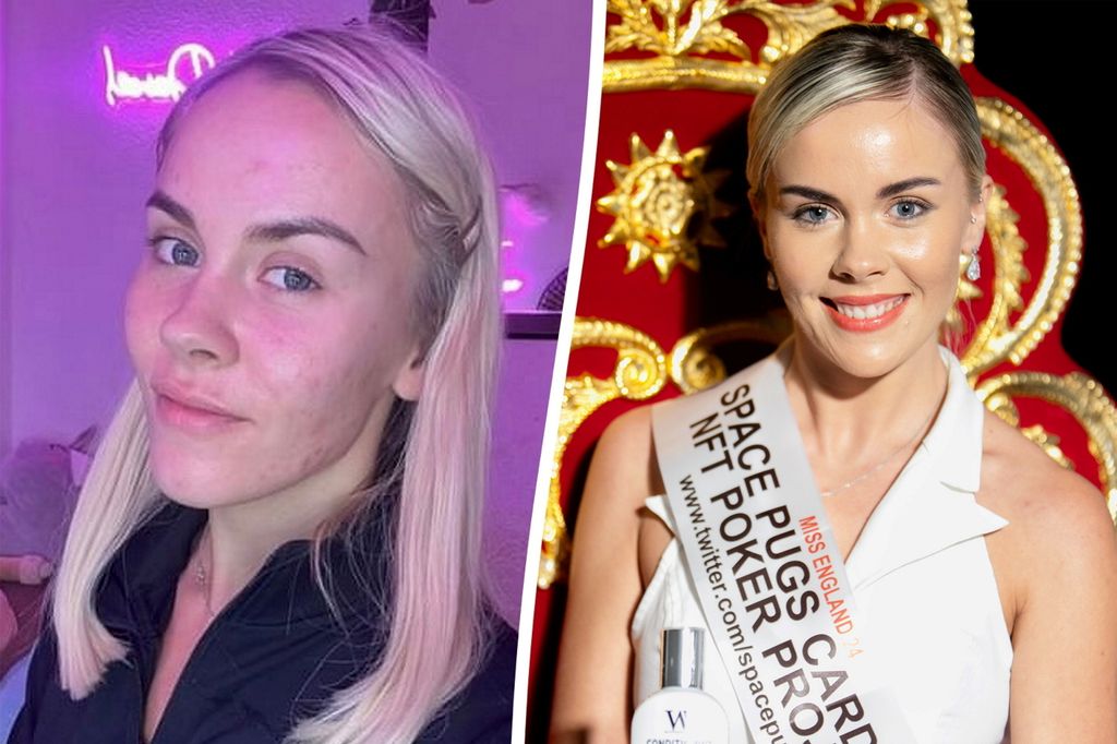 Beauty queens show off imperfections as part of Instagram v Reality campaign