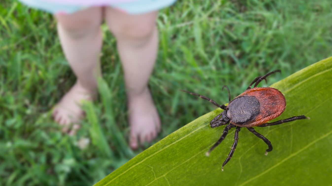 Bare,Child,Feet,And,Deer,Tick,In,Grass,Playground.,Ixodes