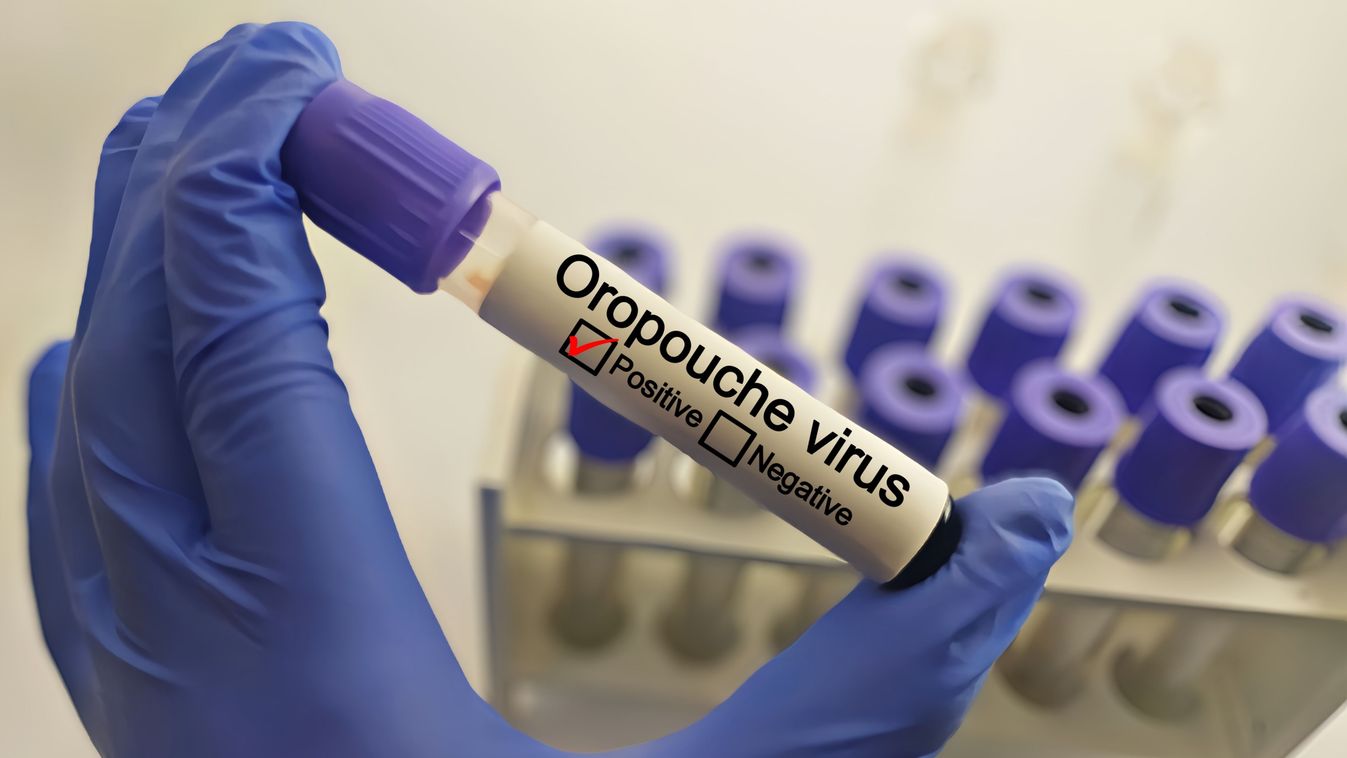 Doctor,With,Oropouche,Virus,Positive,Blood,Sample.,Medical,Laboratory