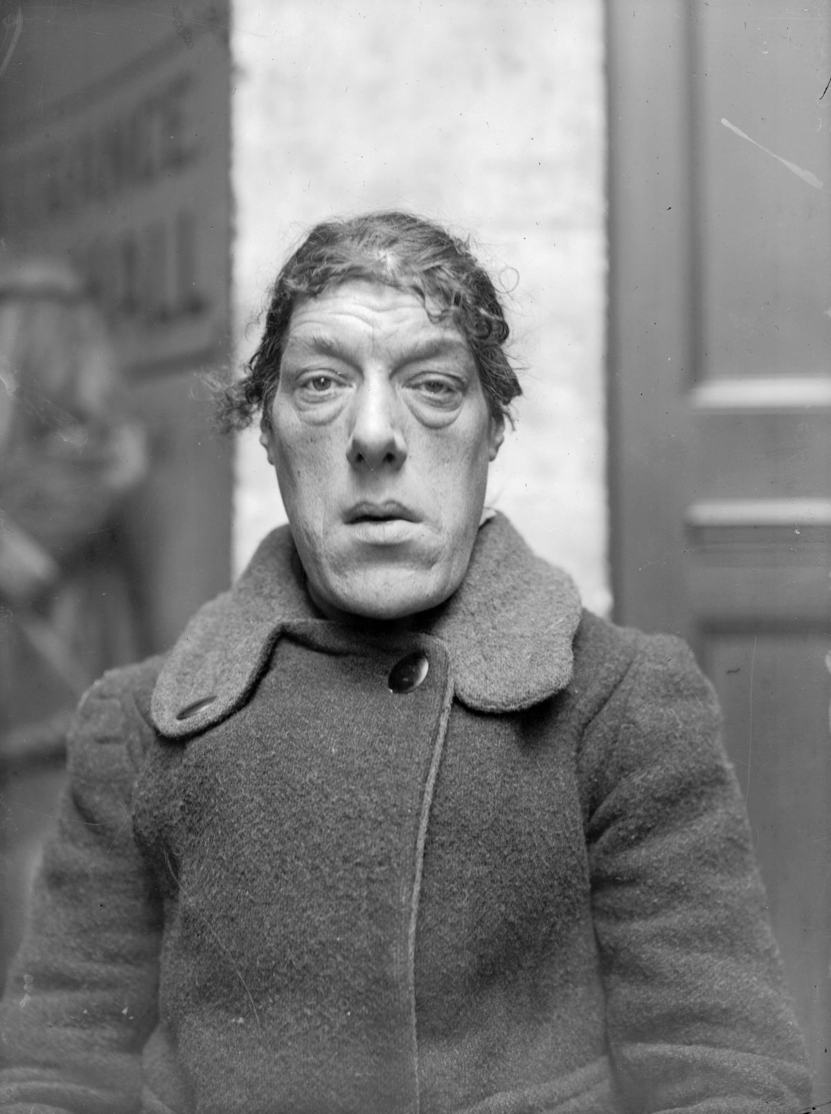 4th November 1919: Mary Ann Bevan (1874 - 1934), also known as Rosie Wilmot, who claimed the title of the 'Ugliest Woman In London'. Bevan suffered from a growth hormone condition known as acromegaly.