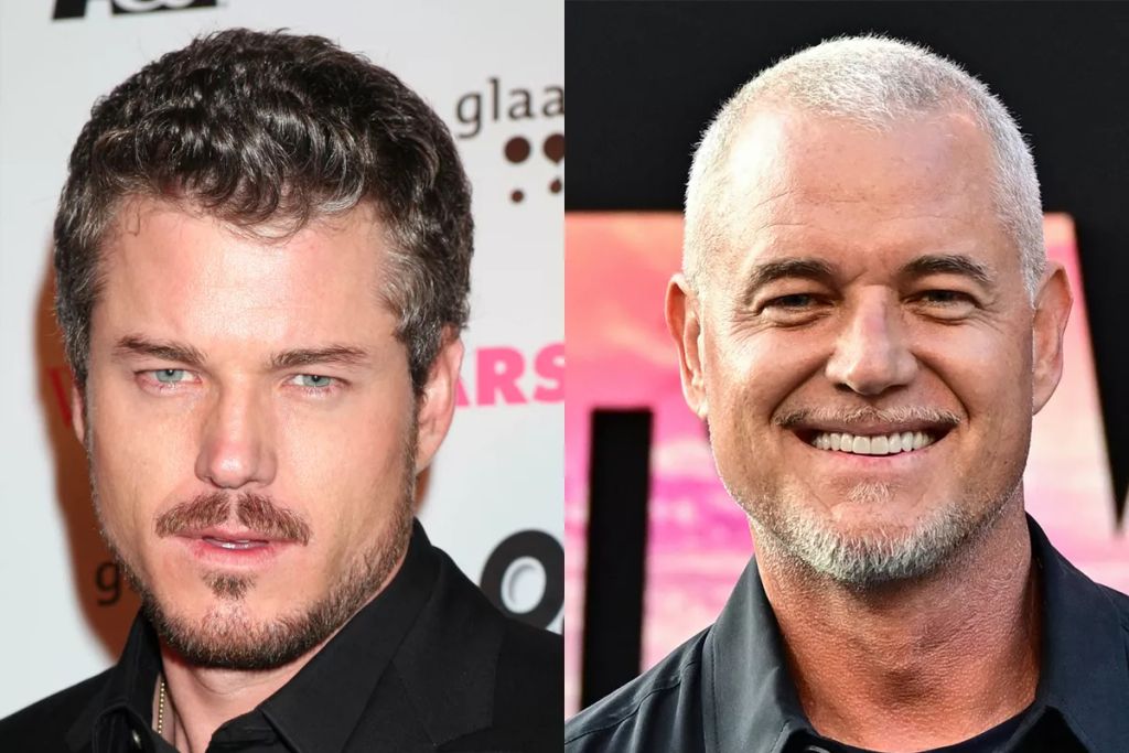 A Mark Sloant alakító Eric Dane manapság nem a szerepeivel, hanem betegségével kerül a figyelem középpontjába. Küzdelmeiről időről időre hírt ad a színész, aki sokak kedvence volt a sorozatban.