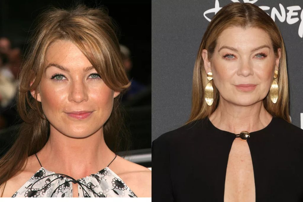 Nem túlzás azt állítani, hogy a sorozat szíve a Meredith Greyt megformáló Ellen Pompeo, aki 20 éve tűri el az elképesztő borzalmakat ugyanolyan profizmussal, mint a kezdetekkor. A színésznőt bár sokan beskatulyázták, nemrégiben hatalmasat alakított a Good American Family című sorozatban is. 