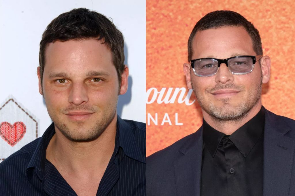 Alex Karev volt a sorozat igazi rosszfiúja, akit lehetetlen volt nem szeretni: néha kicsit szertelen, néha kicsit forrófejű, de mindig csodálatos. Megformálója, Justin Chambers most is elképesztően sármos, legutoljára pedig a Vádlott című filmben szerepelt.
