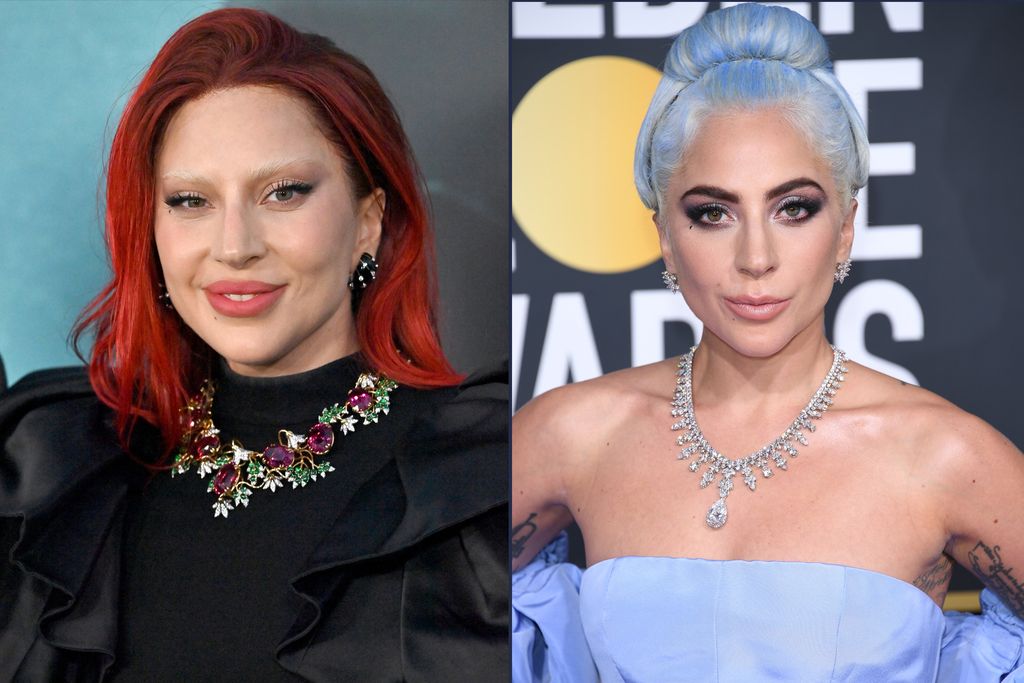 .Lady Gaga