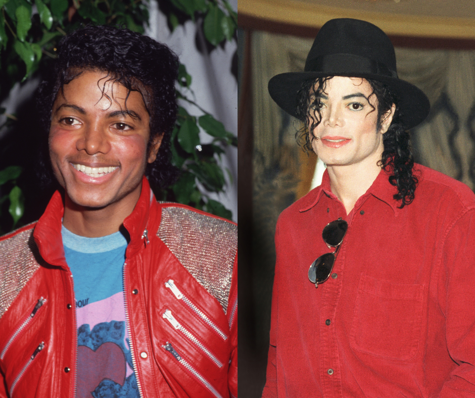 Michael Jackson egy teljesen másik emberré operáltatta magát, a személyiség zavara miatt. 