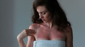 Itt a grillcsirkeszezon, de te ne legyél az! Így győzheted le a napégést, akár azonnal − Termékekkel, árakkal