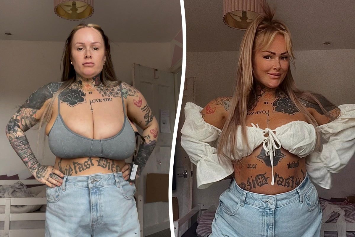 mellkisebbítő műtéten esett át Hannah Davison