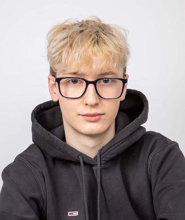 A fiatal influenszer szájfeltöltés miatt lett pikkelysömörös. 