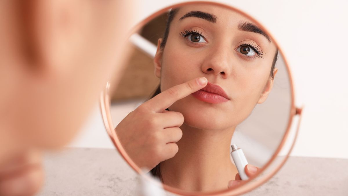 Afta tüneteivel küzdő nő.