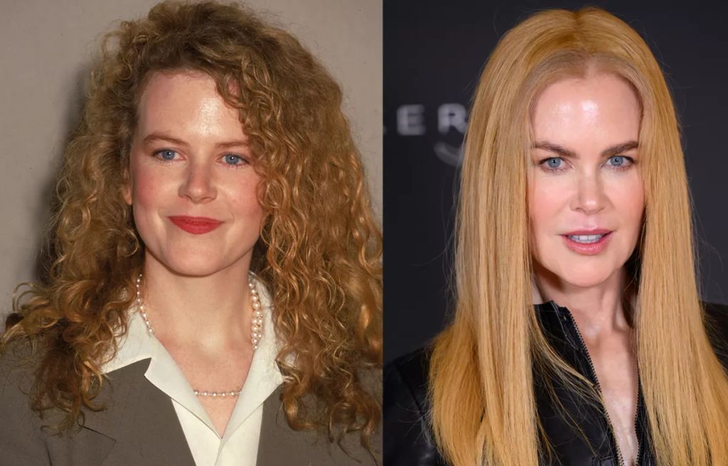 Nicole Kidman színésznő