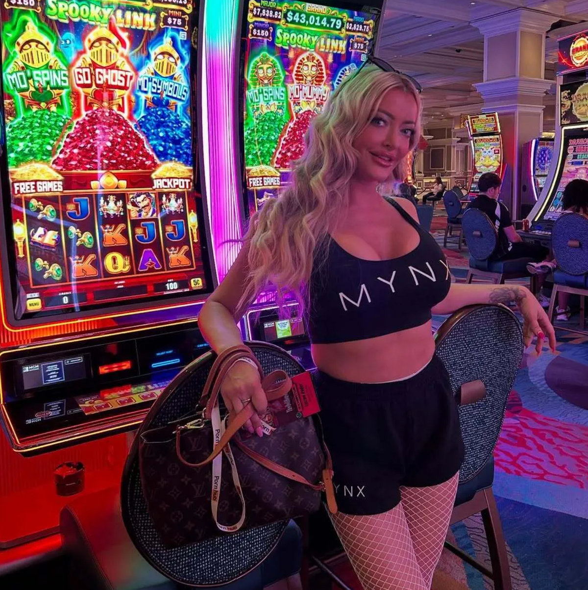 Lynn Harvey a plasztikai műtétek után