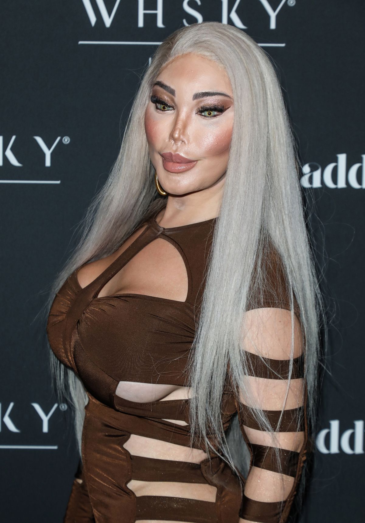 Jessica Alves a plasztikai műtétei után