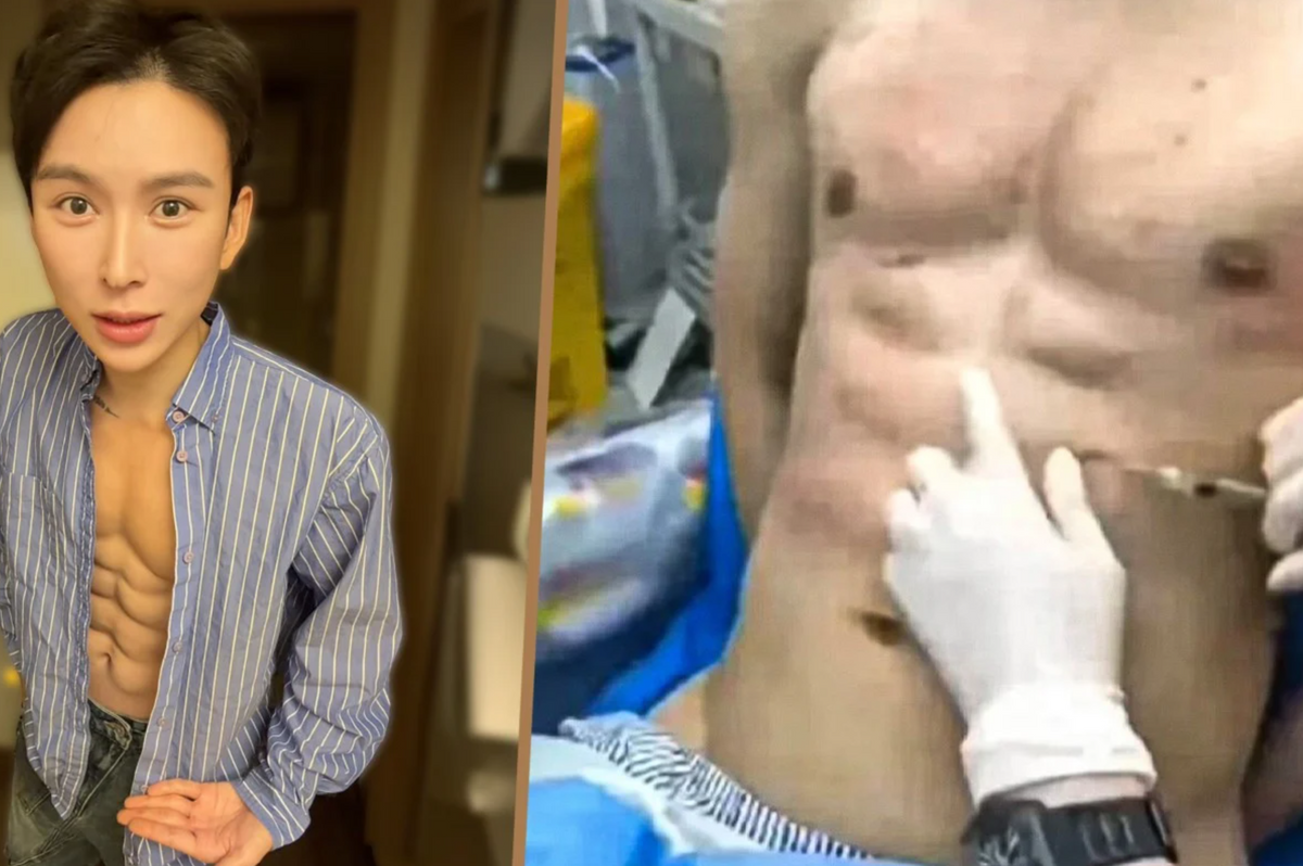 Andy Hao hialuronsavas kockahasa csak illúzió