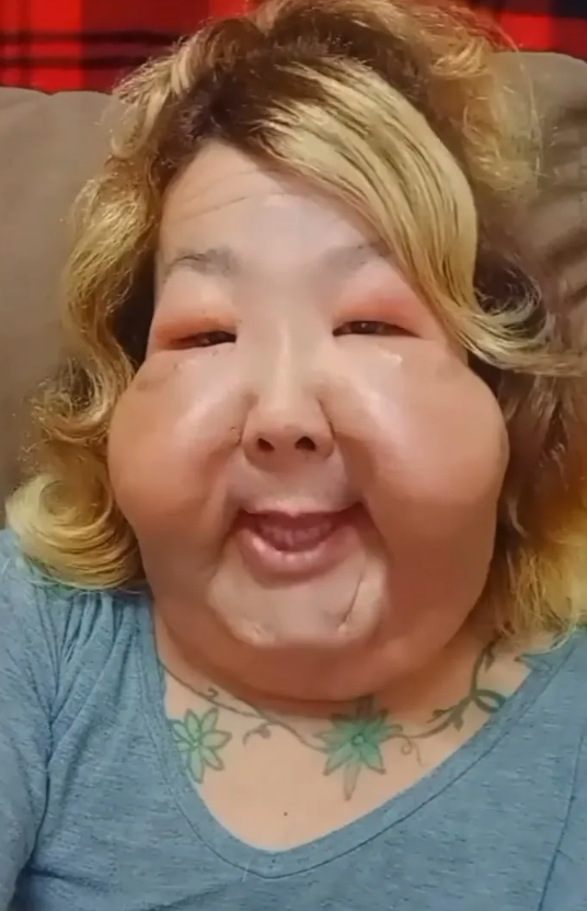 Juliana Oliveira arcplasztikája