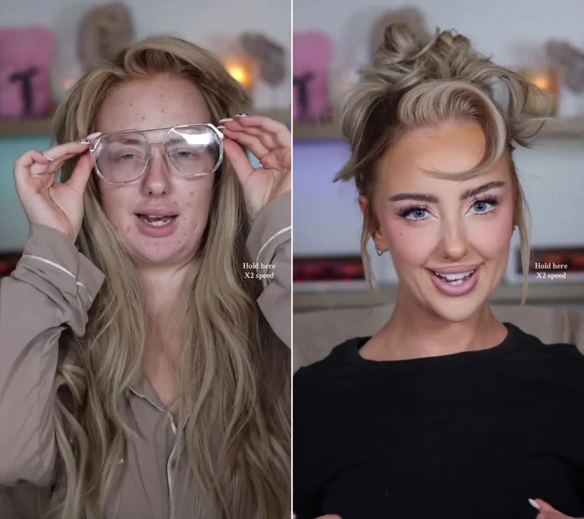 Egy népszerű tiktoker előtte-utána képei