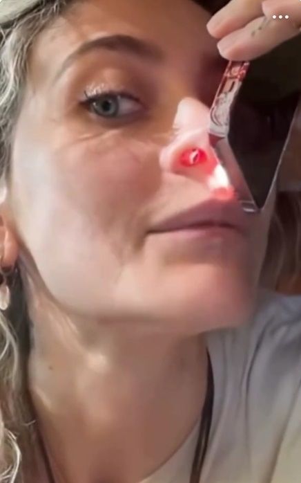 Paris Jackson megmutatta, milyen károkat okozott az orrában a kábítószerer