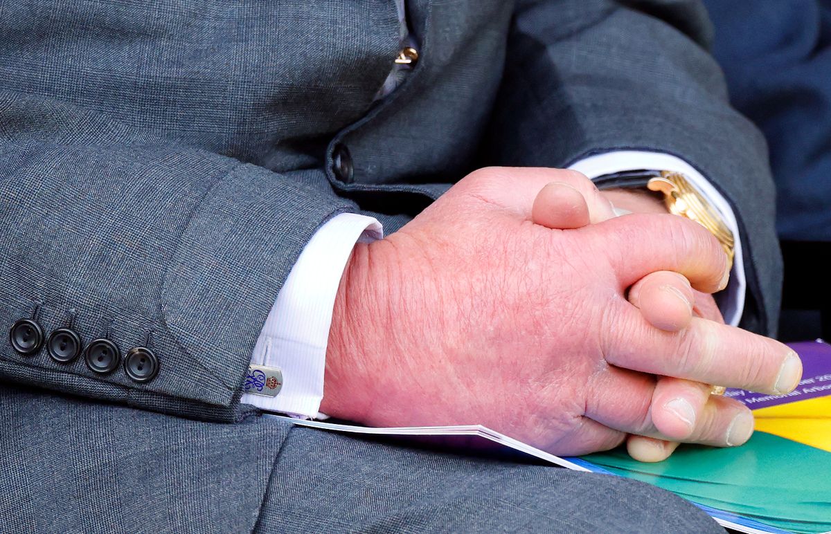 III. Károly király virsliujjai mögött több egészségügyi probléma állhat