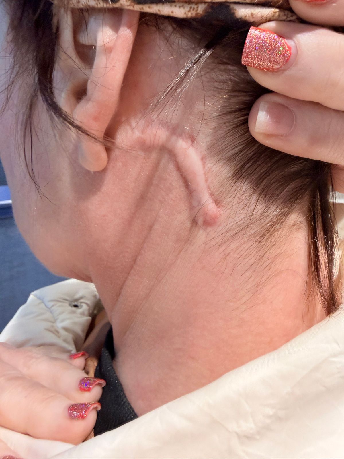 Angela Paterson sebe az arcfelvarrás után