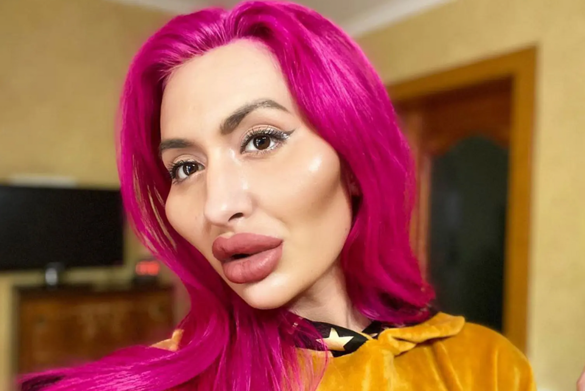 Anastasia Pokreshchuk a plasztikafüggő ukrán modell 