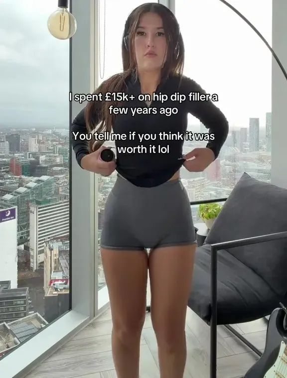 A fiatal tiktoker a plasztikai műtét után. 