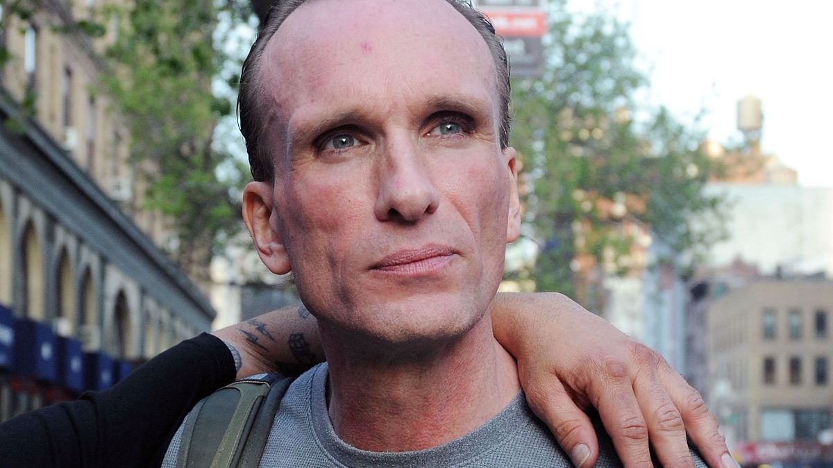 Peter Greene halála előtt még közelgő műtétjére készült