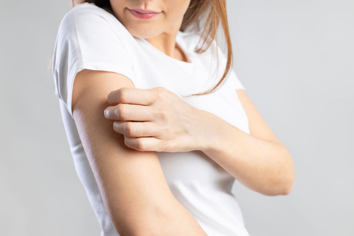 Az ekcéma nem fertőző, gyakran viszket és hajlamos a fellángolásra.