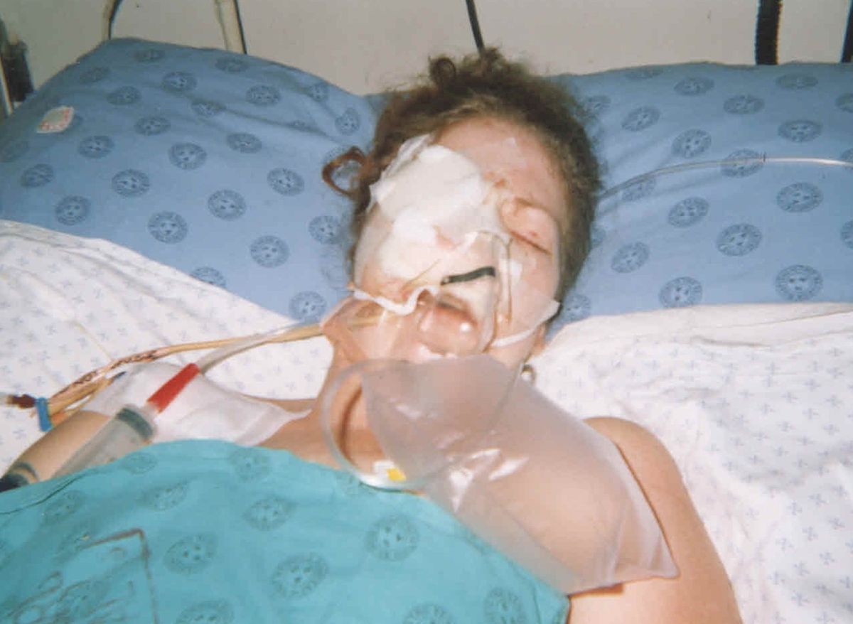 Autóbalesete után fertőzést kapott Vanessa, ami majdnem az életébe került.