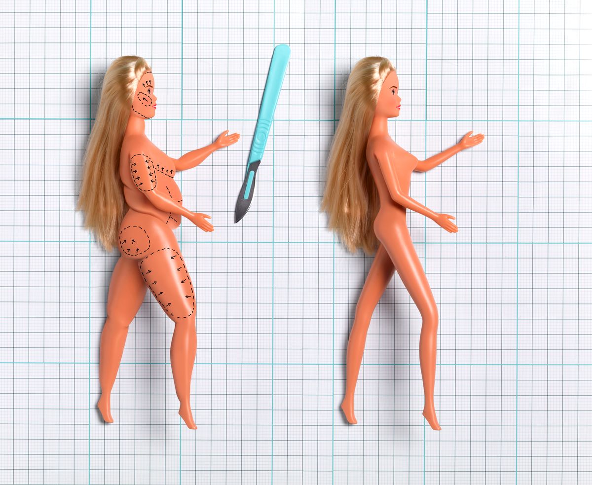 A Barbie-vagina sokak számára az esztétikai tökéletesség szimbóluma lett.