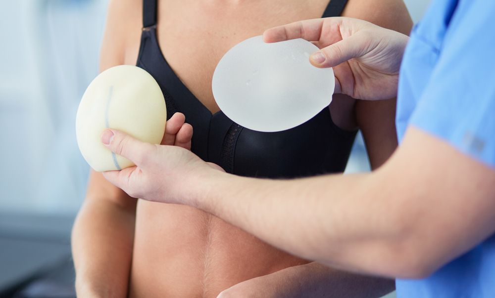 Nő és orvosa implantátumokat próbálgatnak, a fotó a mellpumpáló gyakorlatok cikkhez készült.