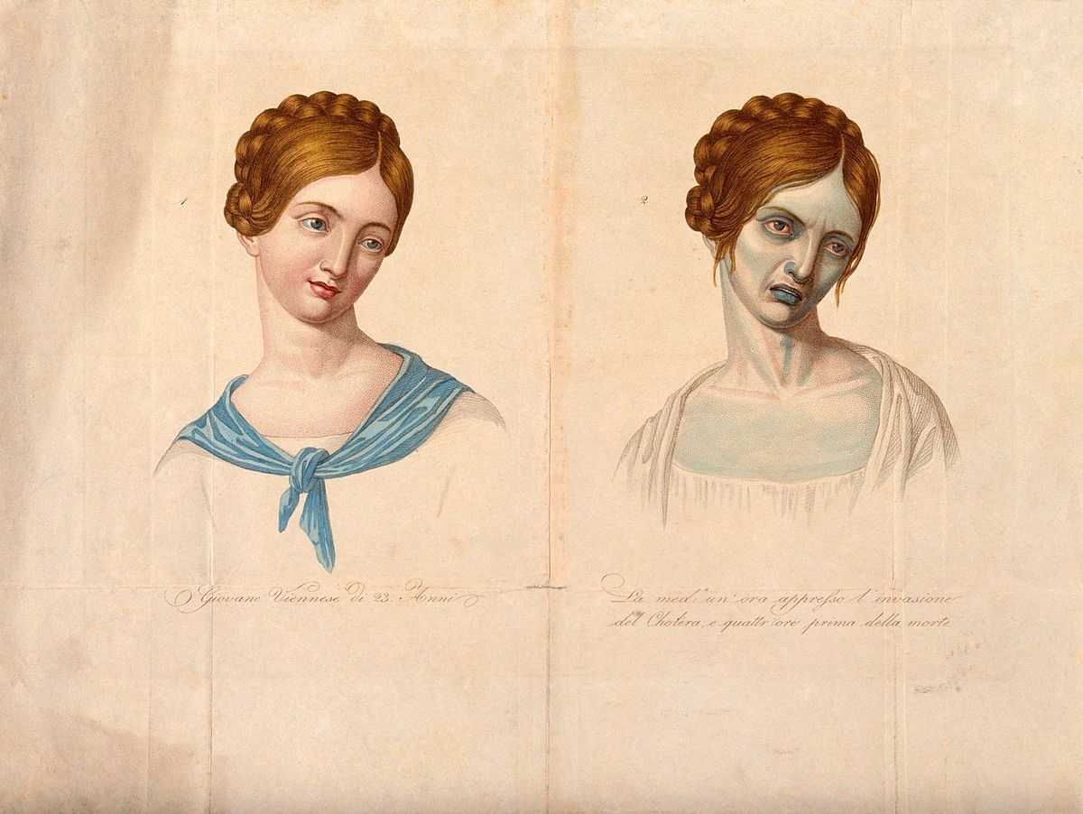 A tuberkulózis tünetei