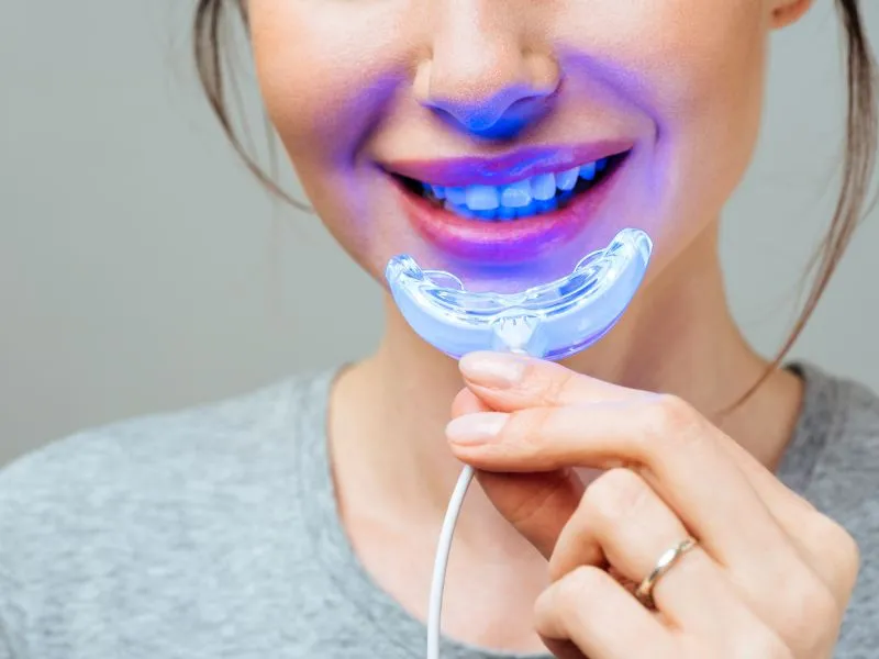 A fogfehérítés otthon is megoldható, de ezekre kell figyelni.