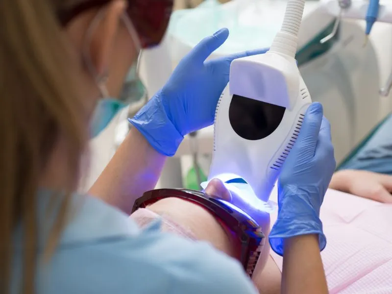 Így működik a rendelői fogfehérítés