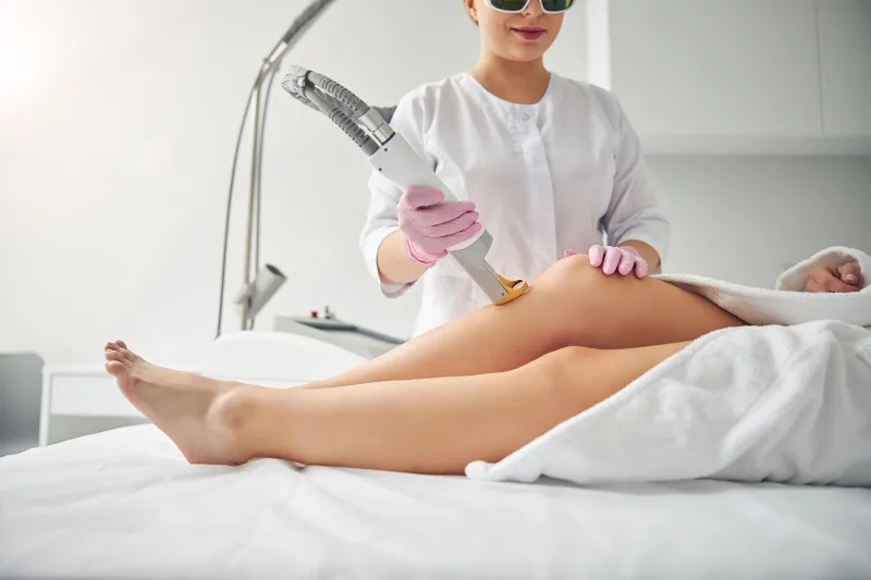 szőrtelenítés IPL