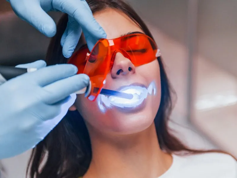 Így működik a rendelői fogfehérítés