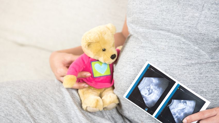 Kvíz kérdést ábrázoló kép.