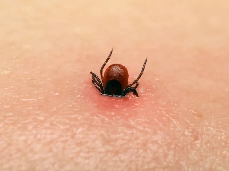 Ezért veszélyes a kullancscsípés