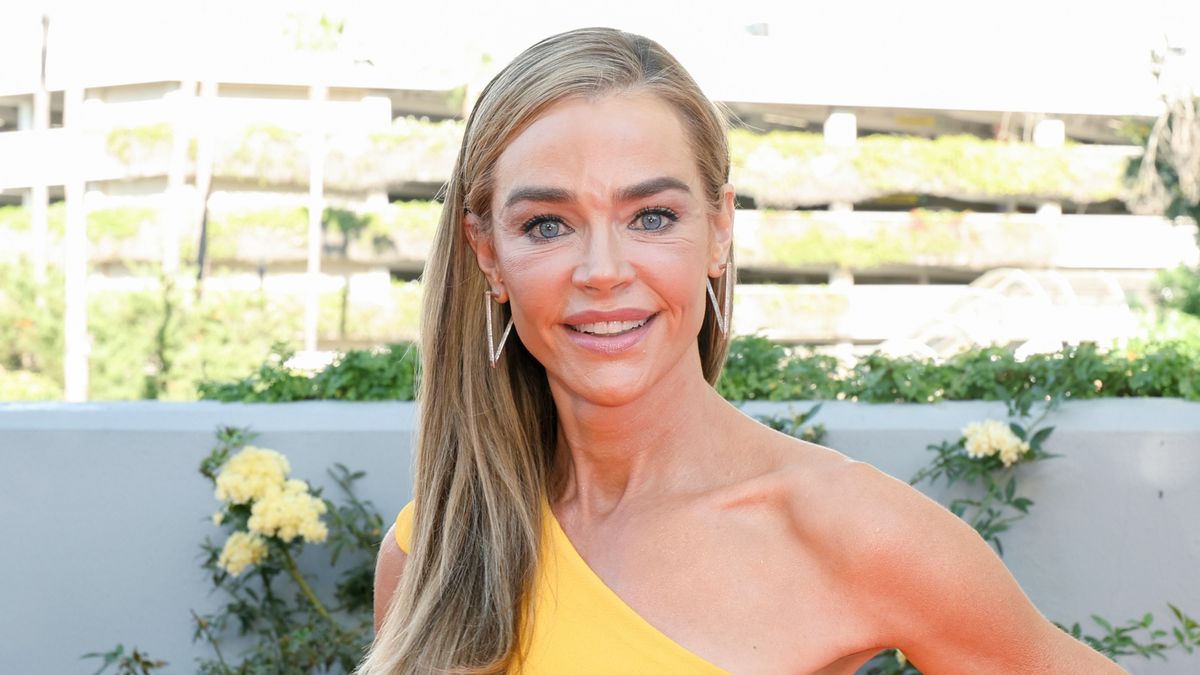 Denise Richards több szépészeti beavatkozáson is átesett - Megmutatta, milyen lett az arca