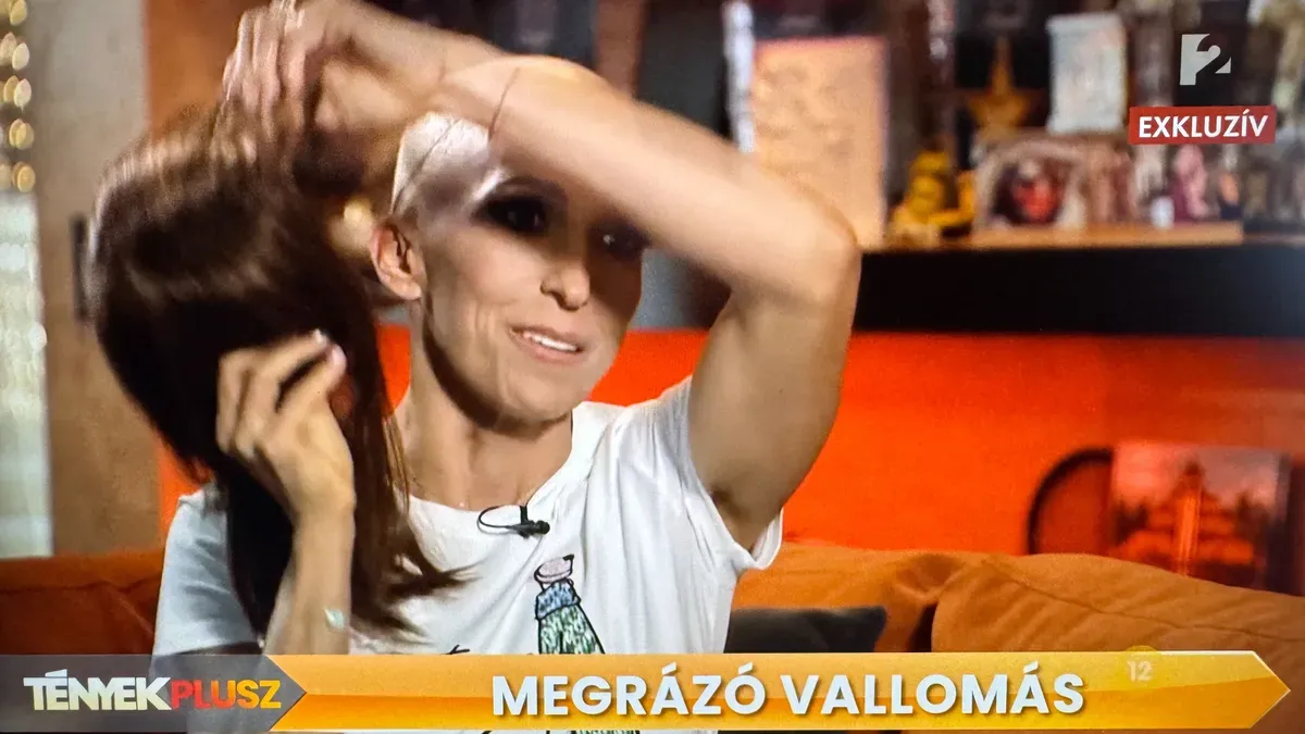 Rubint Réka az interjú közben vette le a parókáját.
