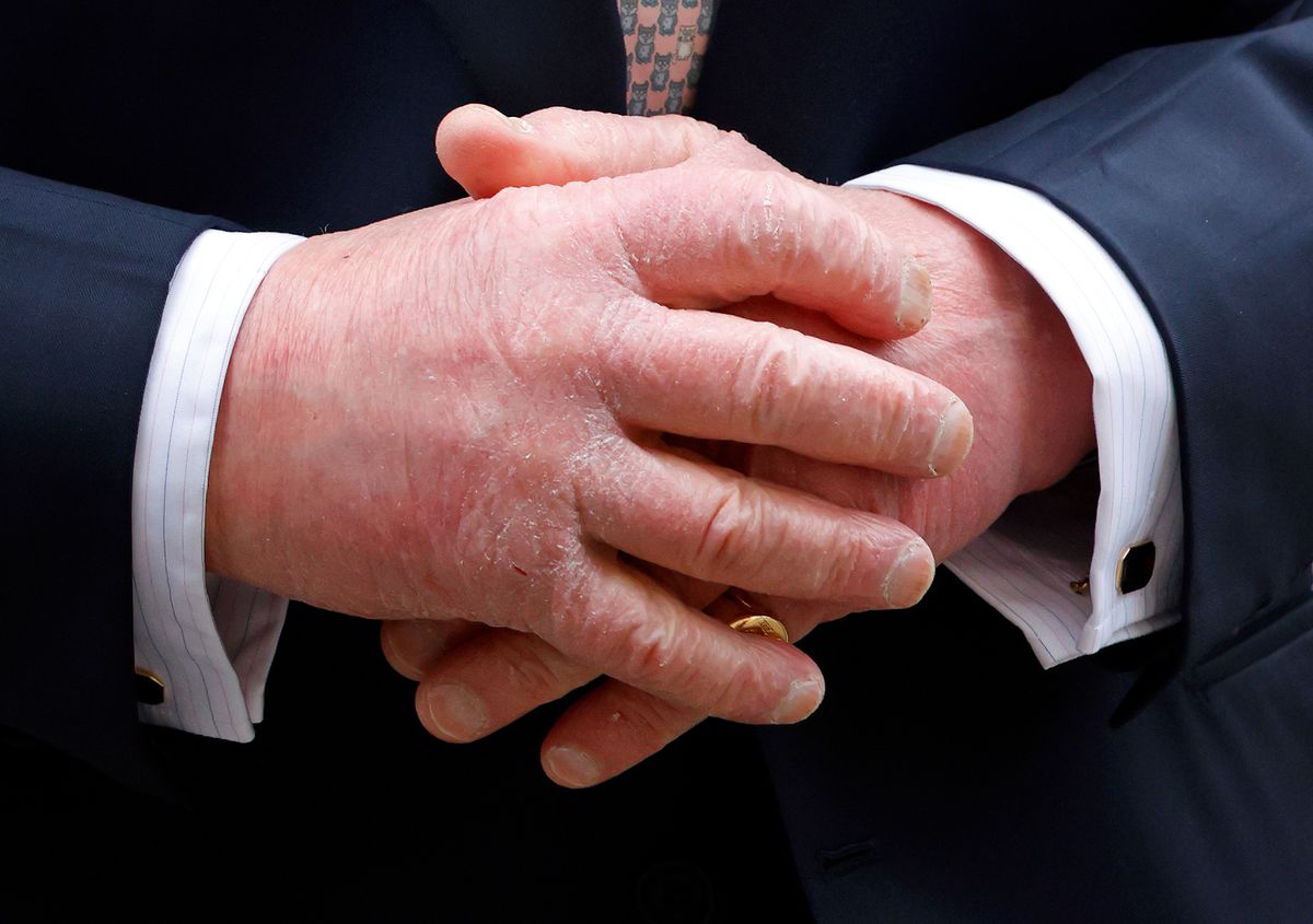 A fotón Károly király kézfeje látható.