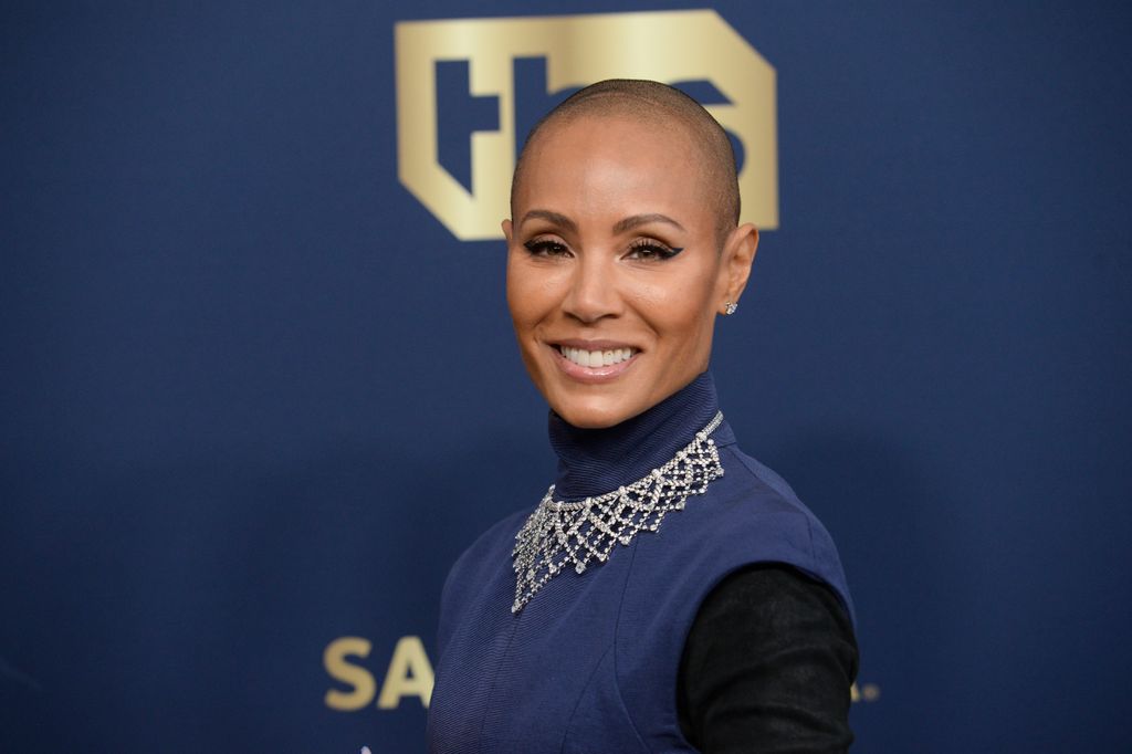 Will Smith felesége, Jada Pinkett Smith alopeciával küzd, egy autoimmun betegséggel, ami miatt kihullott a haja.