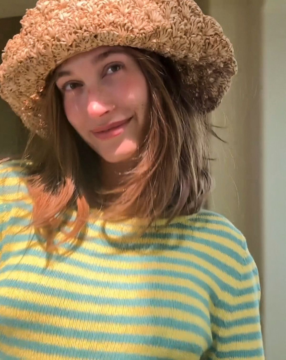 Hailey Bieber szem alatti táskák ellen peptidekkel küzd.