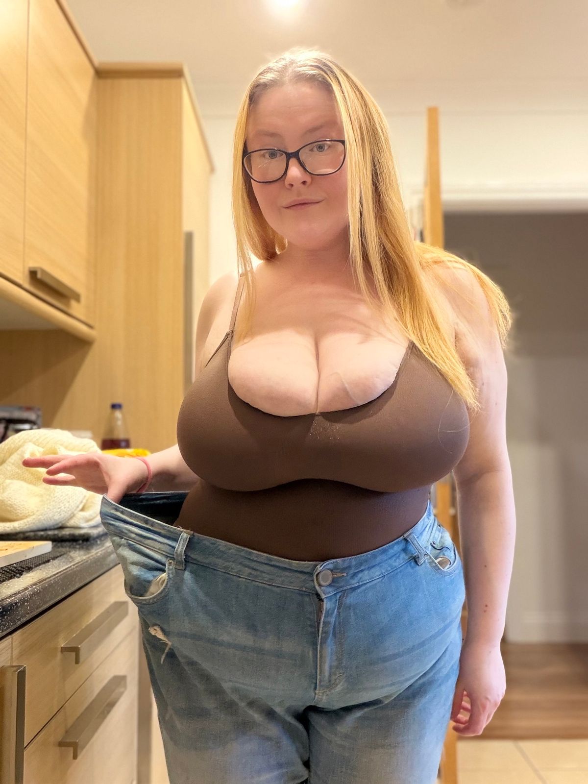 A gigantomastia betegségen szenvedő Tianna Moon