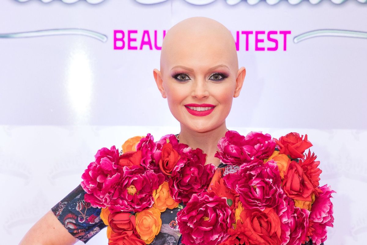 kopasz hírességek: Szűcs Adriána modell