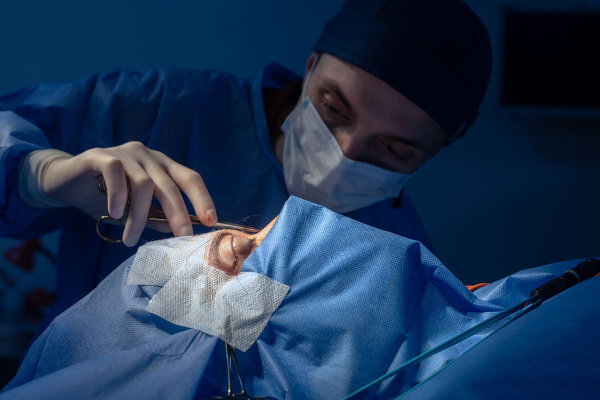 plasztikai beavatkozás