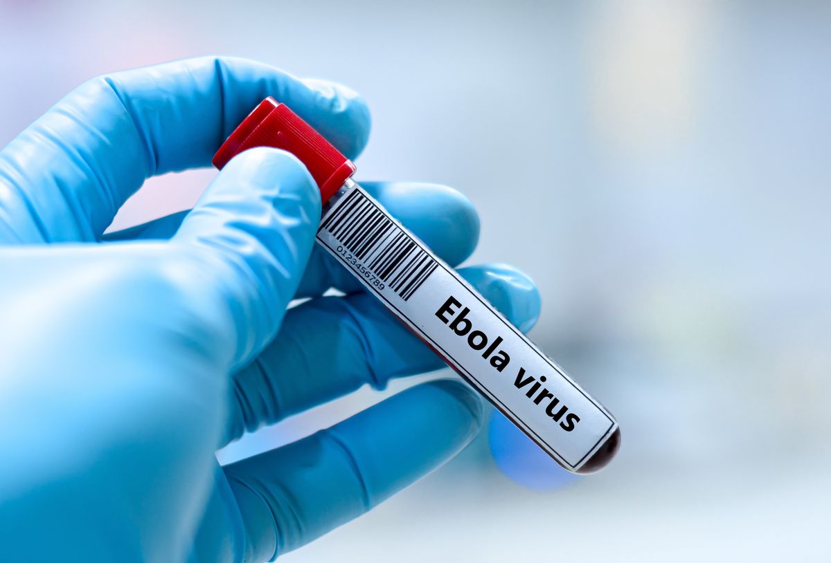 Blood sample tube for ebola virus test analysis.