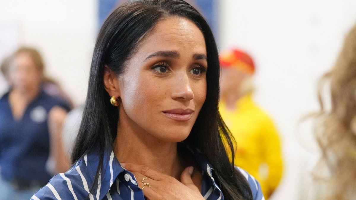 Meghan Markle plasztikai műtéteken eshetett át.
